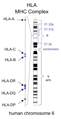 HLA表型(图1)
