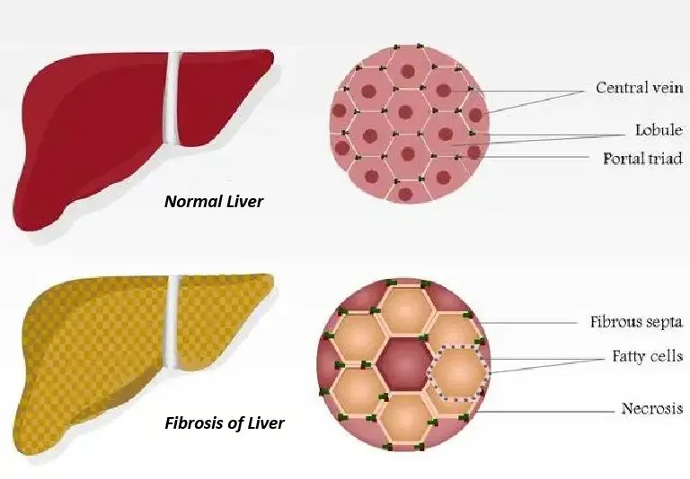 新品上市 | 妙顺生物推出肝星状细胞(图2)