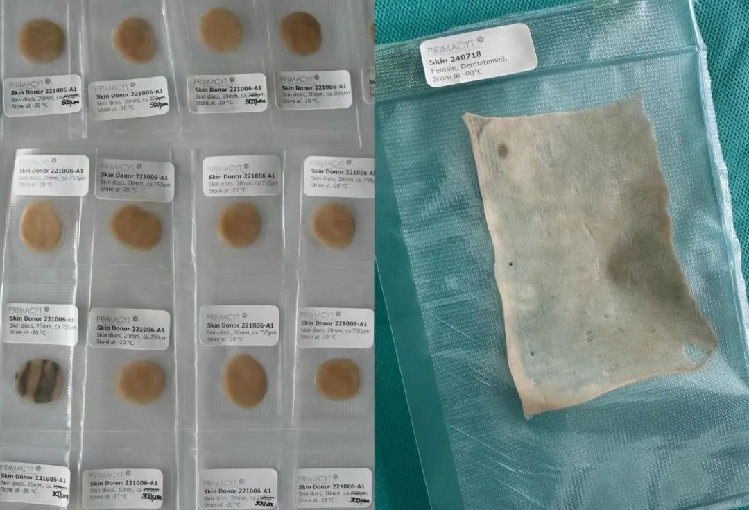 破解“人皮令”合规困局丨妙顺生物重磅推出人源离体皮肤组织解决方案(图2)